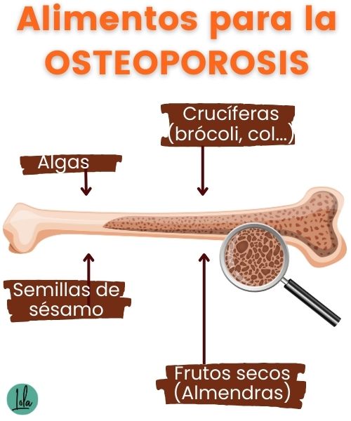 alimentos para osteoporosis