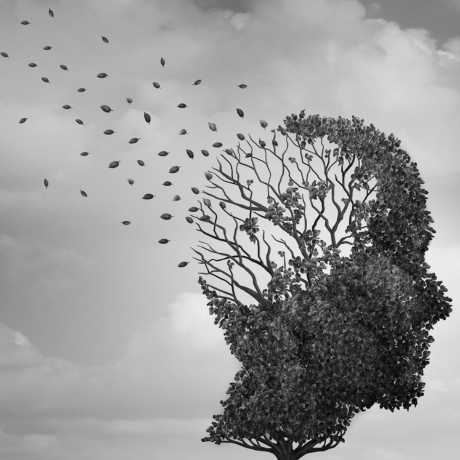 Qué hacer ante la enfermedad de Alzheimer 3