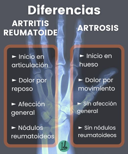 diferencia artritis y artrosis