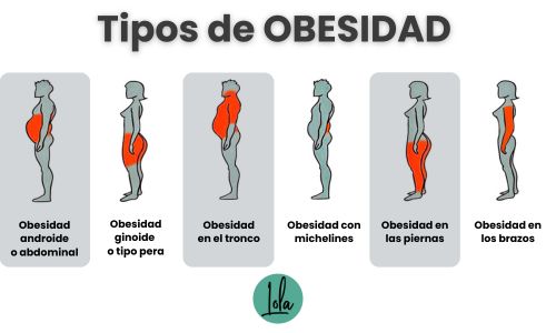 Tipos de obesidad